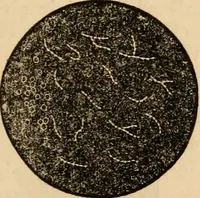 An illustration from The household physician : for the use of families, planters, seamen, and travellers ; being a brief description, in plain language, of all the diseases of men, women, and children, with the newest and most approved methods of curing them / by Ira Warren. (1866)