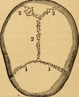 An illustration from The household physician : for the use of families, planters, seamen, and travellers ; being a brief description, in plain language, of all the diseases of men, women, and children, with the newest and most approved methods of curing them / by Ira Warren. (1866)
