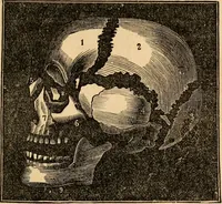 An illustration from The household physician : for the use of families, planters, seamen, and travellers ; being a brief description, in plain language, of all the diseases of men, women, and children, with the newest and most approved methods of curing them / by Ira Warren. (1866)