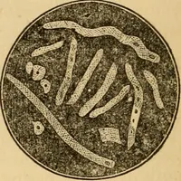 An illustration from The household physician : for the use of families, planters, seamen, and travellers ; being a brief description, in plain language, of all the diseases of men, women, and children, with the newest and most approved methods of curing them / by Ira Warren. (1866)