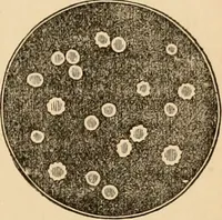 An illustration from The household physician : for the use of families, planters, seamen, and travellers ; being a brief description, in plain language, of all the diseases of men, women, and children, with the newest and most approved methods of curing them / by Ira Warren. (1866)