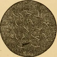 An illustration from The household physician : for the use of families, planters, seamen, and travellers ; being a brief description, in plain language, of all the diseases of men, women, and children, with the newest and most approved methods of curing them / by Ira Warren. (1866)
