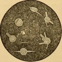 An illustration from The household physician : for the use of families, planters, seamen, and travellers ; being a brief description, in plain language, of all the diseases of men, women, and children, with the newest and most approved methods of curing them / by Ira Warren. (1866)
