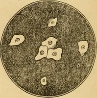 An illustration from The household physician : for the use of families, planters, seamen, and travellers ; being a brief description, in plain language, of all the diseases of men, women, and children, with the newest and most approved methods of curing them / by Ira Warren. (1866)