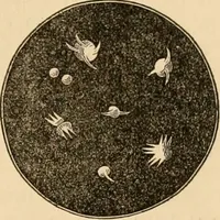 An illustration from The household physician : for the use of families, planters, seamen, and travellers ; being a brief description, in plain language, of all the diseases of men, women, and children, with the newest and most approved methods of curing them / by Ira Warren. (1866)