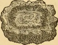 An illustration from The household physician : for the use of families, planters, seamen, and travellers ; being a brief description, in plain language, of all the diseases of men, women, and children, with the newest and most approved methods of curing them / by Ira Warren. (1866)