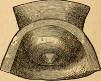 An illustration from The household physician : for the use of families, planters, seamen, and travellers ; being a brief description, in plain language, of all the diseases of men, women, and children, with the newest and most approved methods of curing them / by Ira Warren. (1866)