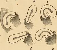 An illustration from The household physician : for the use of families, planters, seamen, and travellers ; being a brief description, in plain language, of all the diseases of men, women, and children, with the newest and most approved methods of curing them / by Ira Warren. (1866)