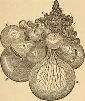 An illustration from The household physician : for the use of families, planters, seamen, and travellers ; being a brief description, in plain language, of all the diseases of men, women, and children, with the newest and most approved methods of curing them / by Ira Warren. (1866)