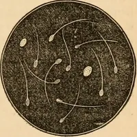 An illustration from The household physician : for the use of families, planters, seamen, and travellers ; being a brief description, in plain language, of all the diseases of men, women, and children, with the newest and most approved methods of curing them / by Ira Warren. (1866)