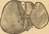 An illustration from The household physician : for the use of families, planters, seamen, and travellers ; being a brief description, in plain language, of all the diseases of men, women, and children, with the newest and most approved methods of curing them / by Ira Warren. (1866)