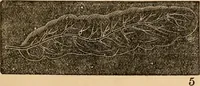 An illustration from The household physician : for the use of families, planters, seamen, and travellers ; being a brief description, in plain language, of all the diseases of men, women, and children, with the newest and most approved methods of curing them / by Ira Warren. (1866)