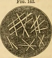 An illustration from The household physician : for the use of families, planters, seamen, and travellers ; being a brief description, in plain language, of all the diseases of men, women, and children, with the newest and most approved methods of curing them / by Ira Warren. (1866)