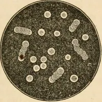 An illustration from The household physician : for the use of families, planters, seamen, and travellers ; being a brief description, in plain language, of all the diseases of men, women, and children, with the newest and most approved methods of curing them / by Ira Warren. (1866)