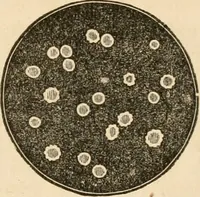 An illustration from The household physician : for the use of families, planters, seamen, and travellers ; being a brief description, in plain language, of all the diseases of men, women, and children, with the newest and most approved methods of curing them / by Ira Warren. (1866)