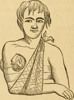 An illustration from The household physician : for the use of families, planters, seamen, and travellers ; being a brief description, in plain language, of all the diseases of men, women, and children, with the newest and most approved methods of curing them / by Ira Warren. (1866)