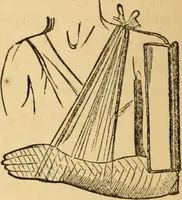 An illustration from The household physician : for the use of families, planters, seamen, and travellers ; being a brief description, in plain language, of all the diseases of men, women, and children, with the newest and most approved methods of curing them / by Ira Warren. (1866)