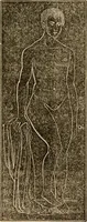 An illustration from The household physician : for the use of families, planters, seamen, and travellers ; being a brief description, in plain language, of all the diseases of men, women, and children, with the newest and most approved methods of curing them / by Ira Warren. (1866)