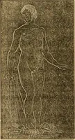 An illustration from The household physician : for the use of families, planters, seamen, and travellers ; being a brief description, in plain language, of all the diseases of men, women, and children, with the newest and most approved methods of curing them / by Ira Warren. (1866)