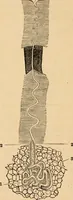 An illustration from The household physician : for the use of families, planters, seamen, and travellers ; being a brief description, in plain language, of all the diseases of men, women, and children, with the newest and most approved methods of curing them / by Ira Warren. (1866)