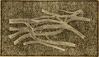 An illustration from The household physician : for the use of families, planters, seamen, and travellers ; being a brief description, in plain language, of all the diseases of men, women, and children, with the newest and most approved methods of curing them / by Ira Warren. (1866)