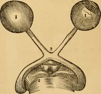 An illustration from The household physician : for the use of families, planters, seamen, and travellers ; being a brief description, in plain language, of all the diseases of men, women, and children, with the newest and most approved methods of curing them / by Ira Warren. (1866)