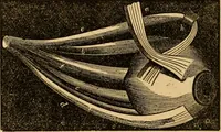 An illustration from The household physician : for the use of families, planters, seamen, and travellers ; being a brief description, in plain language, of all the diseases of men, women, and children, with the newest and most approved methods of curing them / by Ira Warren. (1866)