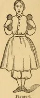 An illustration from The household physician : for the use of families, planters, seamen, and travellers ; being a brief description, in plain language, of all the diseases of men, women, and children, with the newest and most approved methods of curing them / by Ira Warren. (1866)