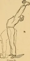 An illustration from The household physician : for the use of families, planters, seamen, and travellers ; being a brief description, in plain language, of all the diseases of men, women, and children, with the newest and most approved methods of curing them / by Ira Warren. (1866)
