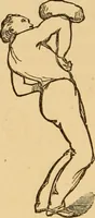 An illustration from The household physician : for the use of families, planters, seamen, and travellers ; being a brief description, in plain language, of all the diseases of men, women, and children, with the newest and most approved methods of curing them / by Ira Warren. (1866)