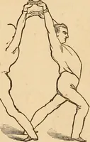 An illustration from The household physician : for the use of families, planters, seamen, and travellers ; being a brief description, in plain language, of all the diseases of men, women, and children, with the newest and most approved methods of curing them / by Ira Warren. (1866)
