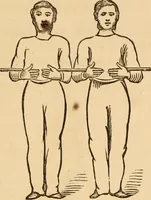 An illustration from The household physician : for the use of families, planters, seamen, and travellers ; being a brief description, in plain language, of all the diseases of men, women, and children, with the newest and most approved methods of curing them / by Ira Warren. (1866)
