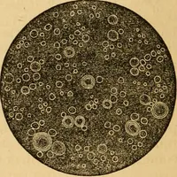 An illustration from The household physician : for the use of families, planters, seamen, and travellers ; being a brief description, in plain language, of all the diseases of men, women, and children, with the newest and most approved methods of curing them / by Ira Warren. (1866)