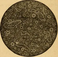 An illustration from The household physician : for the use of families, planters, seamen, and travellers ; being a brief description, in plain language, of all the diseases of men, women, and children, with the newest and most approved methods of curing them / by Ira Warren. (1866)