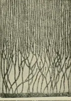 An illustration from Atlas and text-book of dentistry including diseases of the mouth / by Gustav Preiswerk. Edited by George W. Warren. (1906)