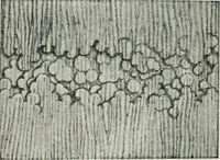 An illustration from Atlas and text-book of dentistry including diseases of the mouth / by Gustav Preiswerk. Edited by George W. Warren. (1906)