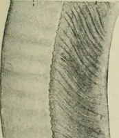 An illustration from Atlas and text-book of dentistry including diseases of the mouth / by Gustav Preiswerk. Edited by George W. Warren. (1906)
