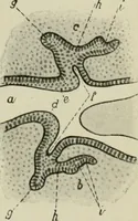 An illustration from Atlas and text-book of dentistry including diseases of the mouth / by Gustav Preiswerk. Edited by George W. Warren. (1906)
