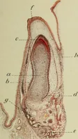 An illustration from Atlas and text-book of dentistry including diseases of the mouth / by Gustav Preiswerk. Edited by George W. Warren. (1906)