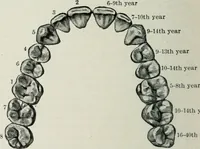 An illustration from Atlas and text-book of dentistry including diseases of the mouth / by Gustav Preiswerk. Edited by George W. Warren. (1906)