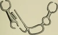 An illustration from Atlas and text-book of dentistry including diseases of the mouth / by Gustav Preiswerk. Edited by George W. Warren. (1906)
