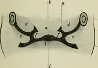 An illustration from Atlas and text-book of dentistry including diseases of the mouth / by Gustav Preiswerk. Edited by George W. Warren. (1906)