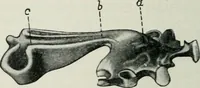 An illustration from Atlas and text-book of dentistry including diseases of the mouth / by Gustav Preiswerk. Edited by George W. Warren. (1906)