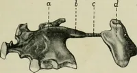 An illustration from Atlas and text-book of dentistry including diseases of the mouth / by Gustav Preiswerk. Edited by George W. Warren. (1906)