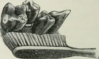 An illustration from Atlas and text-book of dentistry including diseases of the mouth / by Gustav Preiswerk. Edited by George W. Warren. (1906)