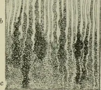 An illustration from Atlas and text-book of dentistry including diseases of the mouth / by Gustav Preiswerk. Edited by George W. Warren. (1906)