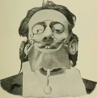 An illustration from Atlas and text-book of dentistry including diseases of the mouth / by Gustav Preiswerk. Edited by George W. Warren. (1906)