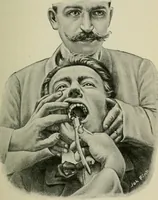 An illustration from Atlas and text-book of dentistry including diseases of the mouth / by Gustav Preiswerk. Edited by George W. Warren. (1906)