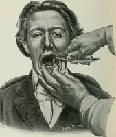 An illustration from Atlas and text-book of dentistry including diseases of the mouth / by Gustav Preiswerk. Edited by George W. Warren. (1906)