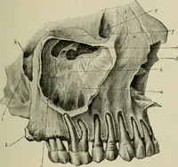 An illustration from Atlas and text-book of dentistry including diseases of the mouth / by Gustav Preiswerk. Edited by George W. Warren. (1906)